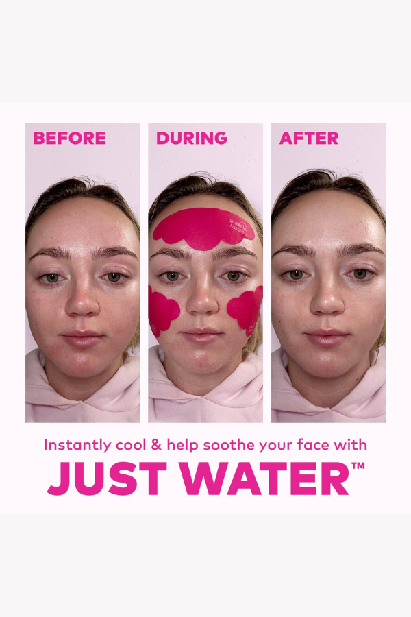 Facial Cooling Clouds Reusable Patches | Instant Cooling